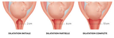 Premier Stade : Amincissement Et Ouverture Du Col De L'Utérus | Institut  National De Santé Publique Du Québec